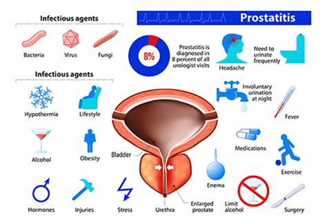 chinese medicine  prostatitis bristol neil kingham