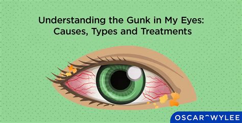 Understanding The Gunk In My Eyes Causes Types And Treatments