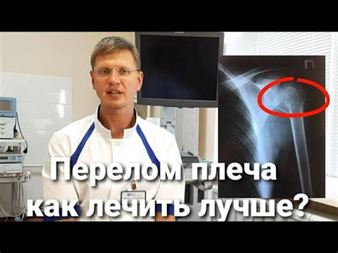 Особенности бандажей и повязок при переломе руки для реабилитации