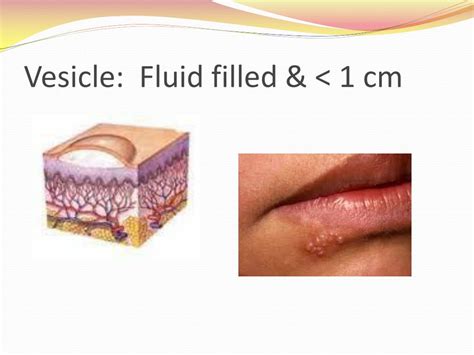 Ppt Pediatric Dermatology Powerpoint Presentation Free Download Id 1415036