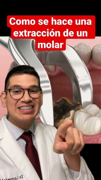 Como Se Hace Una ExtracciÓn Dental ExtracciÓn Dental Shorts Youtube