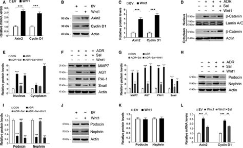 Activation of βcatenin by Wnt1 abolishes the protective effects of