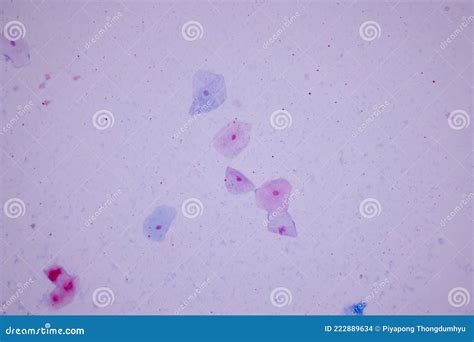 Histological Sample Squamous Epithelial Cells Under Microscope. Stock ...