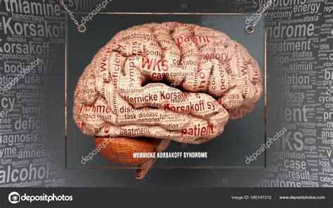 Wernicke Korsakoff Syndrome Dans Cerveau Humain Des Dizaines Termes