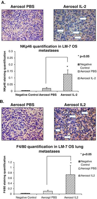 Interleukin 2 Old And New Approaches To Enhance Immune Therapeutic