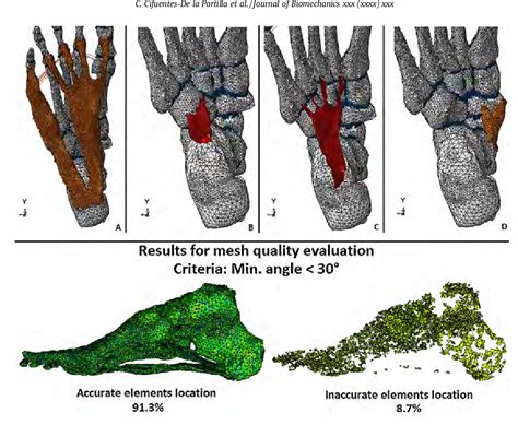 Structure Of Plantar Calcaneonavicular Ligament Semantic Scholar