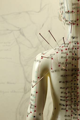 Female Acupuncture Model With Needles In The Shoulder Stock Photo