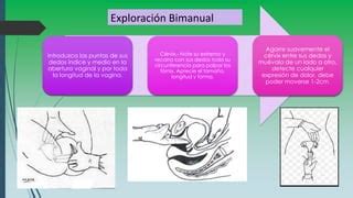 Exploraci N Abdominal Bimanual Ppt