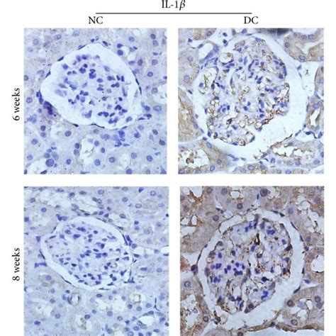 In the immunohistochemistry 400 double TXNIP NLRP3 and IL 1β