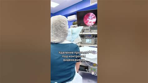 Как проходит гистероскопия? Удаление полипа в матке. - YouTube