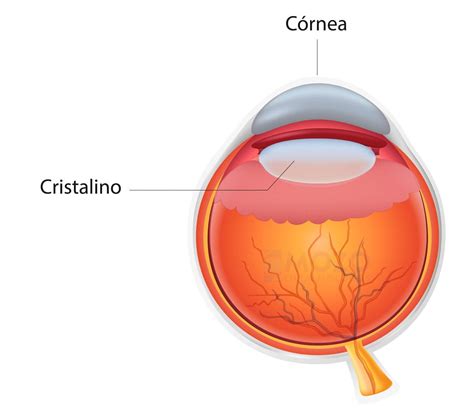 Cirugía refractiva La solución para dejar de usar gafas Mozo