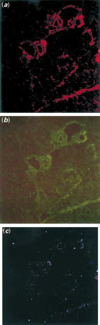 Double Immunofluorescence Followed By Laser Confocal Microscopy