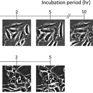 The time course of the morphological changes of the HEp-2 and Hep G2 ...