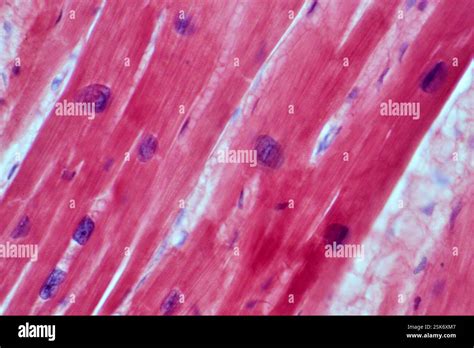 Muscle Tissue Of The Heart
