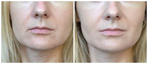 Rysichka: Collistar Foundation + Concealer Total Perfection Duo