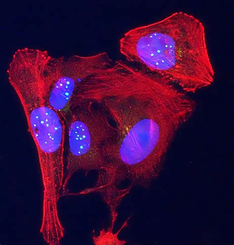 Maria Blasco: Unraveling The Secrets Of Aging And Cancer With Telomeres