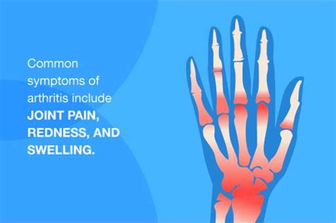 Recognizing the symptoms of arthritis