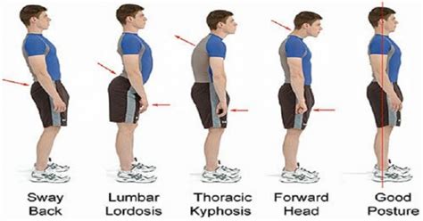 Common Posture Mistakes That May Be Affecting Your Health And Ways To Fix Them Neopress