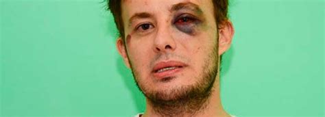 Joven gay denuncio discrimiación y golpes en un boliche de Santa Rosa Diario Sur Digital