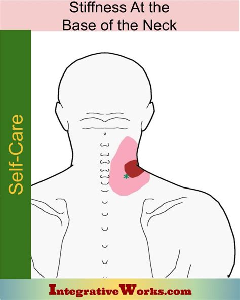 Neck Pain Base Of Head