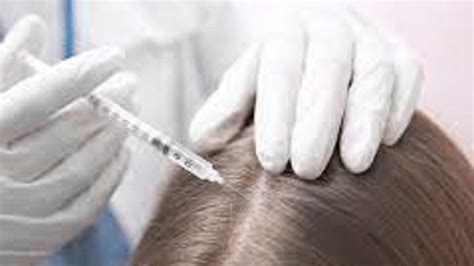 Prp Pour Les Cheveux Tout Ce Qu Il Faut Savoir Sur Ces Injections