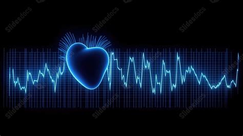 Best Ekg Powerpoint Background For Presentation - Slidesdocs.com