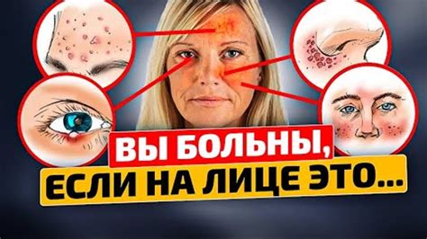 Смотрите, как органы ЗАРАНЕЕ ПРЕДУПРЕЖДАЮТ о БОЛЕЗНИ! Диагностика ...