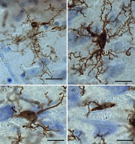 Morphometric Characterization Of Microglial Phenotypes In Human