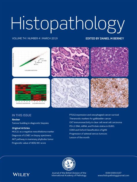 Histopathology: Vol 74, No 4
