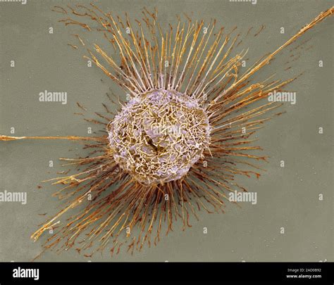 Lung epithelial cell. Coloured scanning electron micrograph (SEM) of a ...