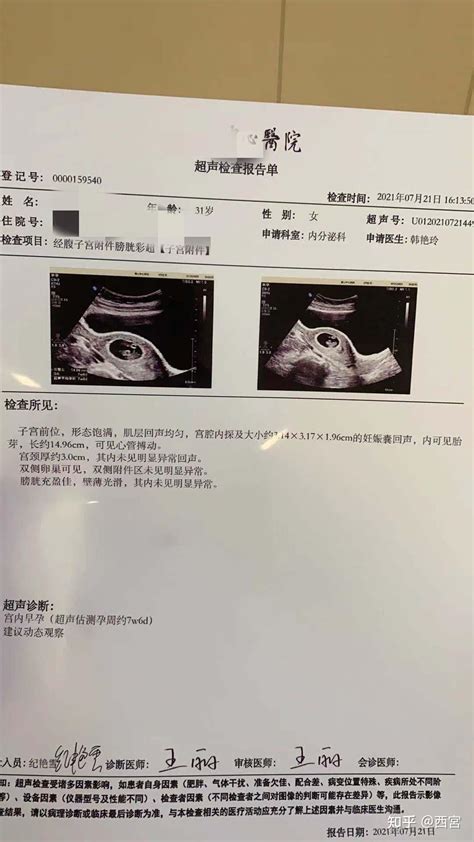 洗精试管婴儿怀孕后续 知乎