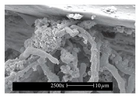Scanning electron microscopy images of the tip and cuff of the central ... 