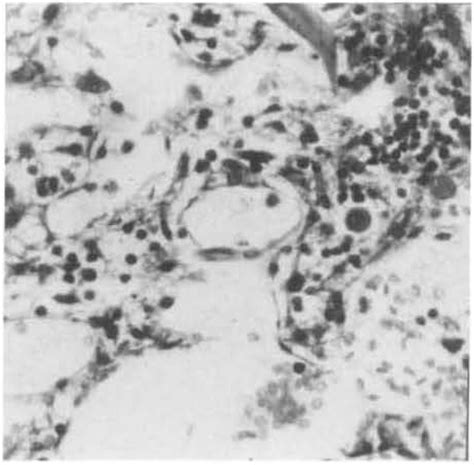 Plate 2 Bone Marrow Of A Male B6c3f1 Mouse Given 200 Mg Azt 400 Mg Rifampicin Per Kg Body