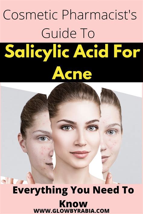 Everything You Need To Know About Salicylic Acid For Acne Artofit