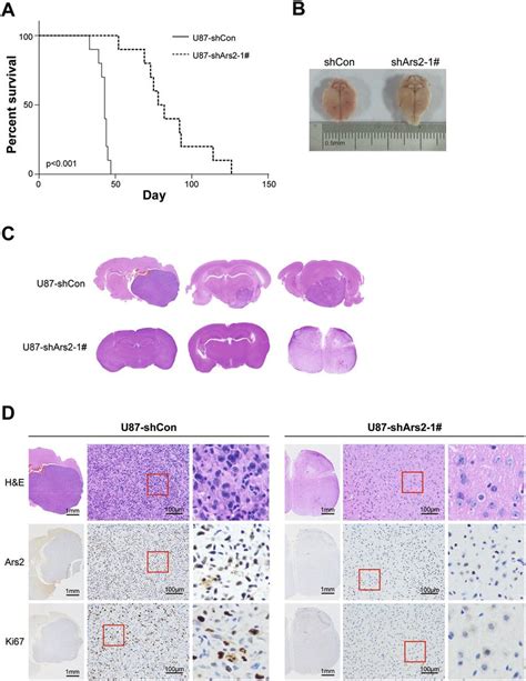 Depletion Of Ars2 Inhibited Tumor Growth In Orthotopic Glioblastoma