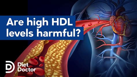 Are High Hdl Levels Harmful Youtube