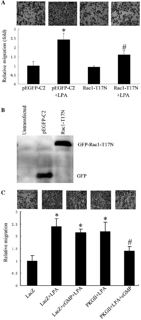 Pkg Ii Inhibits Lpa Induced Cell Migration Which Is Dependent On Rac