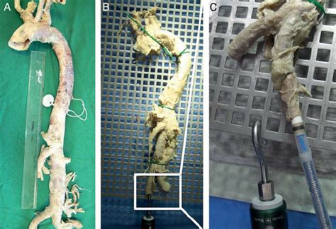 A Human Aorta After Conservation B Human Aorta On The