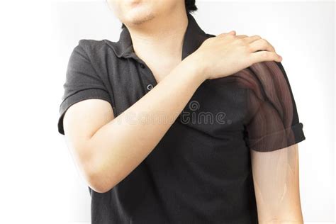 Shoulder muscle injury stock photo. Image of deltoid - 134578626