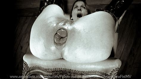 REALLY EXTREME ANAL Pics XHamster