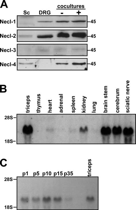 Necl protein expression and Necl-4 mRNA expression. (A) Western blot ...