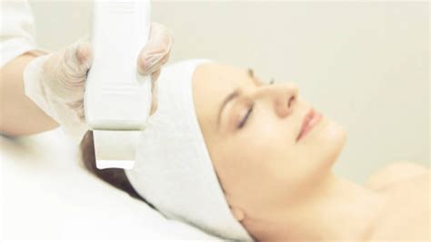 Laser Lavieen Melasma Dellavi Biomedicina Est Tica