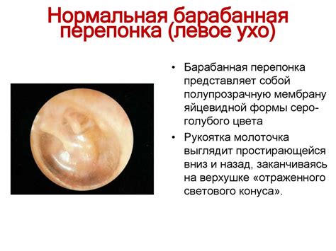 Барабанные перепонки лопнули: Можно ли восстановить барабанную перепонку?