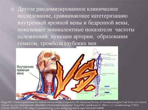 Катетеризация центральных вен - презентация онлайн