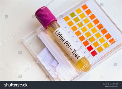 Urine Ph Test Look Abnormalities Urine Stock Photo 2234873625 ...