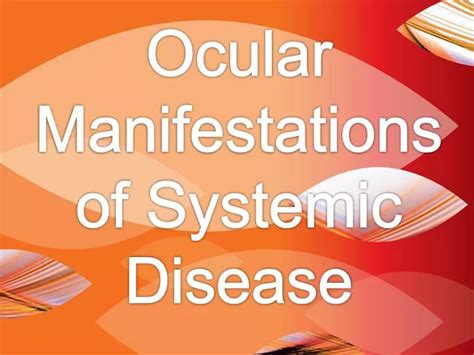 PPT Ocular Manifestations Of Systemic Disease PowerPoint Presentation