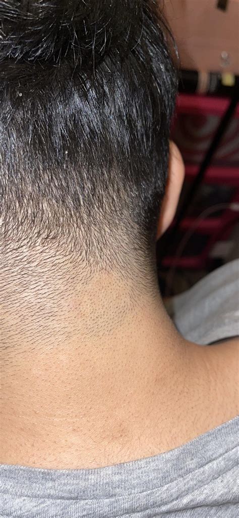 Anybody know if this a bald spot growing or a ringworm? : r/Hair