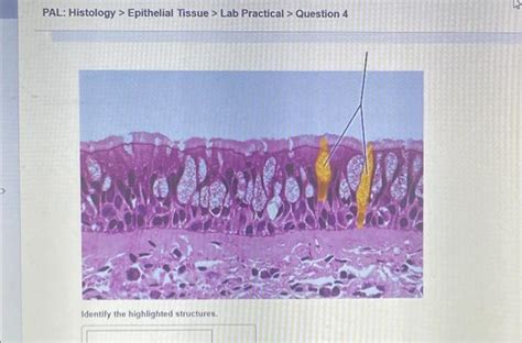 Solved Pal Histology Epithelial Tissue Lab Practical Chegg