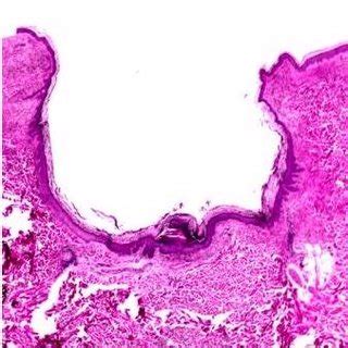 (PDF) Dilated Pore of Winer, Dr. Louis H Winer and Wine Glass