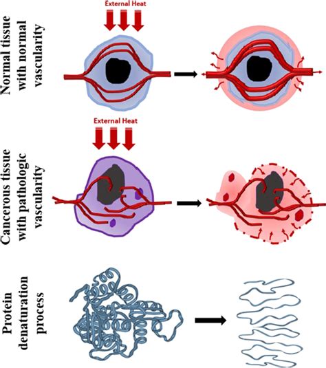 Hyperthermia Treatment Mechanism On Cellular Level Download